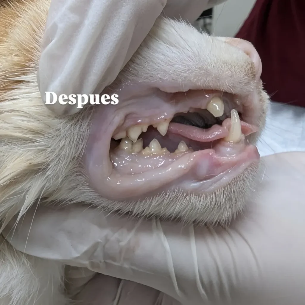 destartraje (limpieza dental profesional)