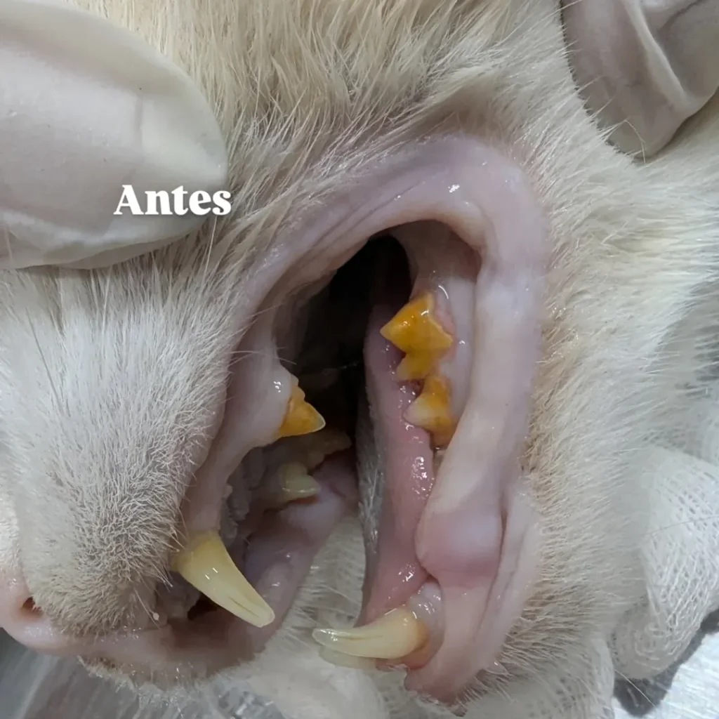 destartraje (limpieza dental profesional)