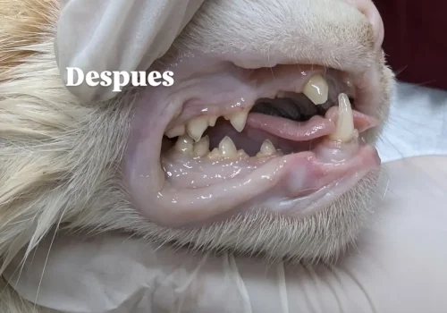destartraje (limpieza dental profesional)